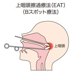 72579 B