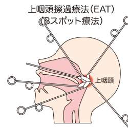 578354 B