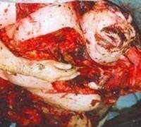 87007 B