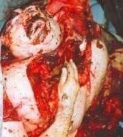87255 B
