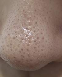 154854 B